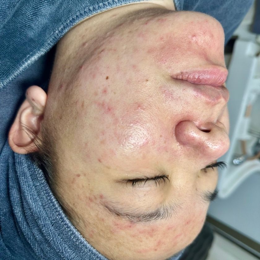 Before