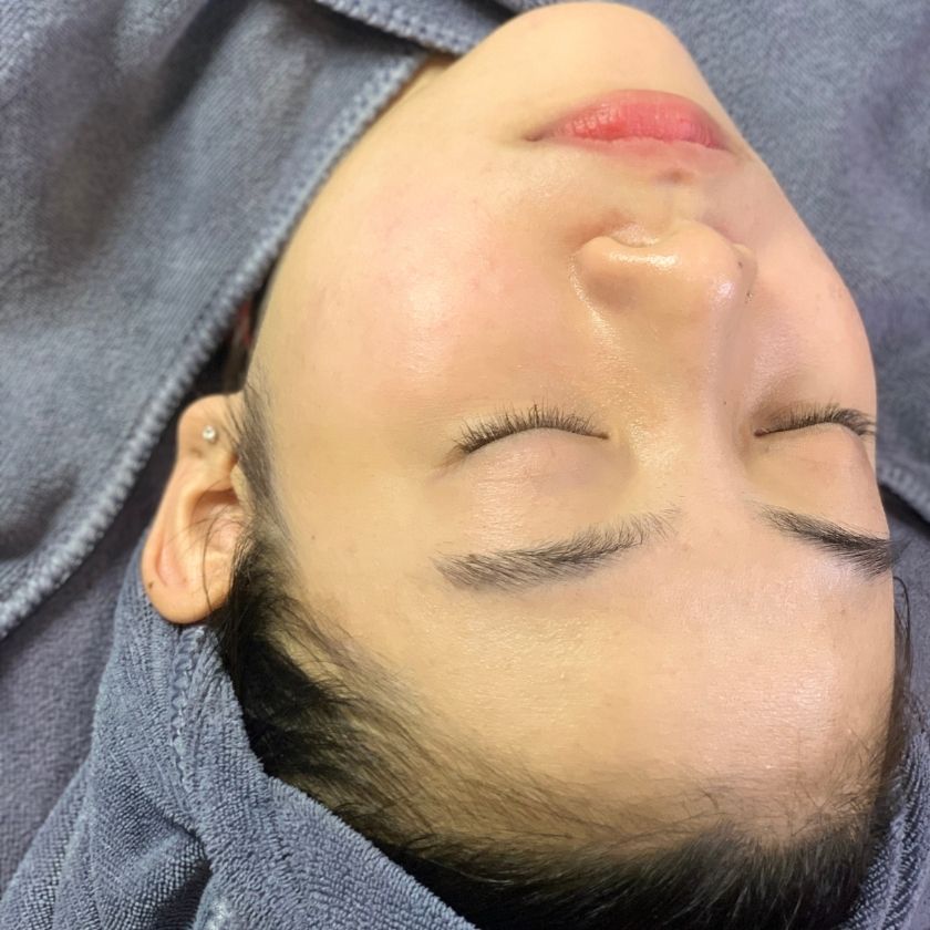 After