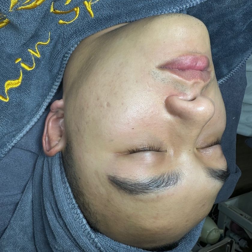 After